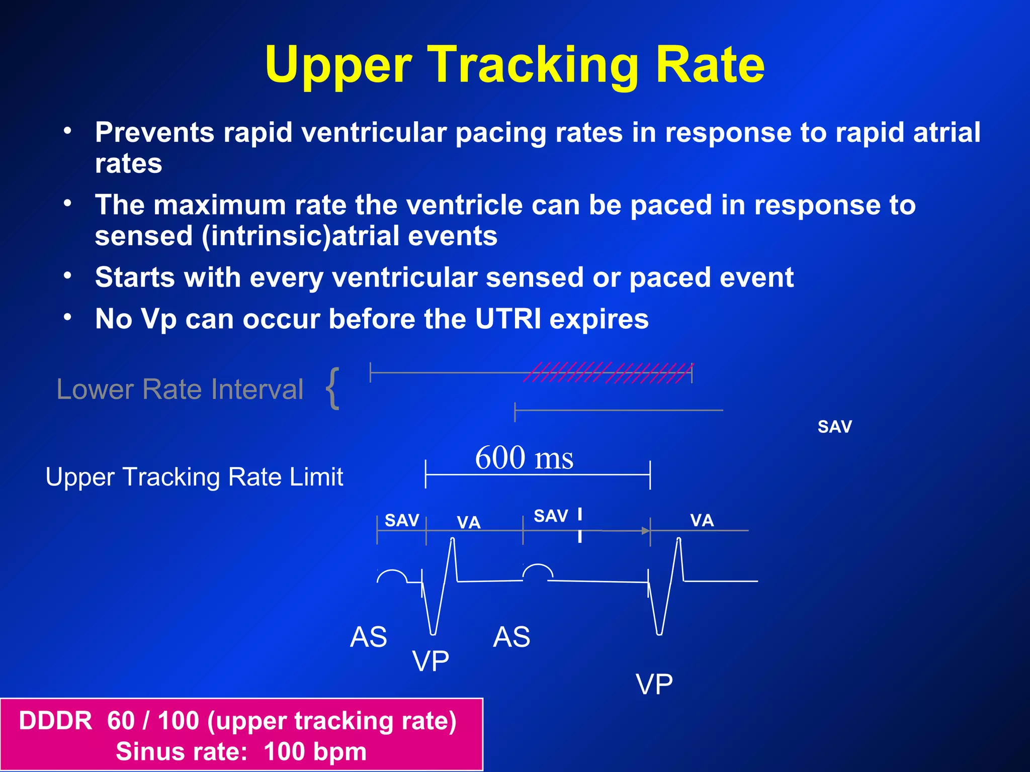 AS
VP
AS
VP
DDDR 60 / 100 (upper tracking rate)
Sinus rate: 100 bpm
Lower Rate Interval {
Upper Tracking Rate Limit
Upper Tracking Rate
SAV
SAV
VA VA
• Prevents rapid ventricular pacing rates in response to rapid atrial
rates
• The maximum rate the ventricle can be paced in response to
sensed (intrinsic)atrial events
• Starts with every ventricular sensed or paced event
• No Vp can occur before the UTRI expires
SAV
600 ms
 