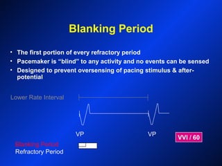 Blanking Period
Lower Rate Interval
VP VP
VVI / 60
• The first portion of every refractory period
• Pacemaker is “blind” to any activity and no events can be sensed
• Designed to prevent oversensing of pacing stimulus & after-
potential
Blanking Period
Refractory Period
 