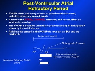 Post Ventricular Atrial
Refractory Period (PVARP)
Post-Ventricular Atrial
Refractory Period
• PVARP starts with every sensed or paced ventricular event,
including refractory sensed events
• It renders the ATRIAL CHANNEL refractory and has no effect on
ventricular sensing
• The PVARP is intended primarily to prevent sensing of retrograde P
waves by the atrial channel
• Atrial events sensed in the PVARP do not start an SAV and are
marked Ar
AP
VPVentricular Refractory Period
(VRP)
Retrograde P wave
Lower Rate Interval
AR
 