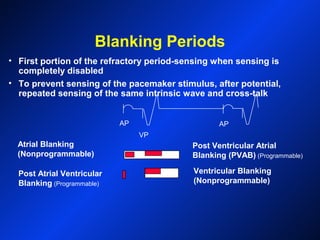 Blanking Periods
• First portion of the refractory period-sensing when sensing is
completely disabled
• To prevent sensing of the pacemaker stimulus, after potential,
repeated sensing of the same intrinsic wave and cross-talk
AP
VP
AP
Post Ventricular Atrial
Blanking (PVAB) (Programmable)
Post Atrial Ventricular
Blanking (Programmable)
Ventricular Blanking
(Nonprogrammable)
Atrial Blanking
(Nonprogrammable)
 