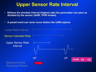 Upper Sensor Rate Interval
Lower Rate Interval
VP VP
VVIR / 60 / 120
• Defines the shortest interval (highest rate) the pacemaker can pace as
dictated by the sensor (AAIR, VVIR modes)
• A paced event can never occur before the UARI expires
Blanking Period
Refractory Period
Upper Sensor Rate
Interval
Sensor Indicated Rate
 