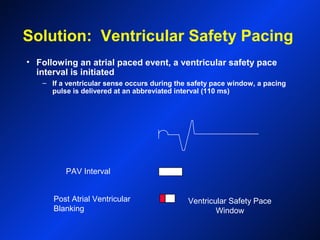 Solution: Ventricular Safety Pacing
• Following an atrial paced event, a ventricular safety pace
interval is initiated
– If a ventricular sense occurs during the safety pace window, a pacing
pulse is delivered at an abbreviated interval (110 ms)
Post Atrial Ventricular
Blanking
PAV Interval
Ventricular Safety Pace
Window
 