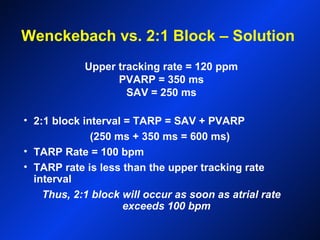 Wenckebach vs. 2:1 Block – Solution
Upper tracking rate = 120 ppm
PVARP = 350 ms
SAV = 250 ms
• 2:1 block interval = TARP = SAV + PVARP
(250 ms + 350 ms = 600 ms)
• TARP Rate = 100 bpm
• TARP rate is less than the upper tracking rate
interval
Thus, 2:1 block will occur as soon as atrial rate
exceeds 100 bpm
 