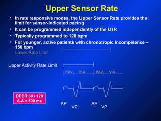 DDDR 60 / 120
A-A = 500 ms
AP
VP
AP
VP
Upper Activity Rate Limit
Lower Rate Limit
V-APAV V-APAV
Upper Sensor Rate
• In rate responsive modes, the Upper Sensor Rate provides the
limit for sensor-indicated pacing
• It can be programmed independently of the UTR
• Typically programmed to 120 bpm
• For younger, active patients with chronotropic incompetence –
150 bpm
 