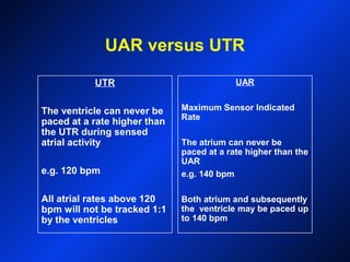 UAR versus UTR
UTR
The ventricle can never be
paced at a rate higher than
the UTR during sensed
atrial activity
e.g. 120 bpm
All atrial rates above 120
bpm will not be tracked 1:1
by the ventricles
UAR
Maximum Sensor Indicated
Rate
The atrium can never be
paced at a rate higher than the
UAR
e.g. 140 bpm
Both atrium and subsequently
the ventricle may be paced up
to 140 bpm
 
