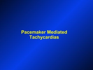 Pacemaker Mediated
Tachycardias
 
