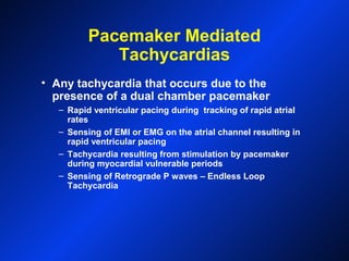 Pacemaker Mediated
Tachycardias
• Any tachycardia that occurs due to the
presence of a dual chamber pacemaker
– Rapid ventricular pacing during tracking of rapid atrial
rates
– Sensing of EMI or EMG on the atrial channel resulting in
rapid ventricular pacing
– Tachycardia resulting from stimulation by pacemaker
during myocardial vulnerable periods
– Sensing of Retrograde P waves – Endless Loop
Tachycardia
 