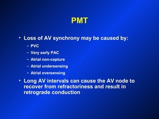 PMT
• Loss of AV synchrony may be caused by:
– PVC
– Very early PAC
– Atrial non-capture
– Atrial undersensing
– Atrial oversensing
• Long AV intervals can cause the AV node to
recover from refractoriness and result in
retrograde conduction
 