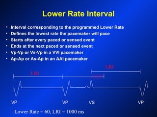 VP VP VS VP
Lower Rate Interval
• Interval corresponding to the programmed Lower Rate
• Defines the lowest rate the pacemaker will pace
• Starts after every paced or sensed event
• Ends at the next paced or sensed event
• Vp-Vp or Vs-Vp in a VVI pacemaker
• Ap-Ap or As-Ap in an AAI pacemaker
LRI
LRI
Lower Rate = 60, LRI = 1000 ms
 