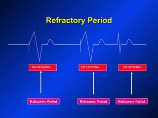 Refractory PeriodRefractory Period
Refractory Period Refractory Period Refractory Period
NO SENSING NO SENSING NO SENSING
 