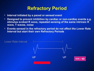 Refractory Period
Lower Rate Interval
VP VP
VVI / 60
• Interval initiated by a paced or sensed event
• Designed to prevent inhibition by cardiac or non-cardiac events e.g.
stimulus evoked R wave, repeated sensing of the same intrinsic R
wave, T waves, noise
• Events sensed in the refractory period do not affect the Lower Rate
Interval but start their own Refractory Periods
 