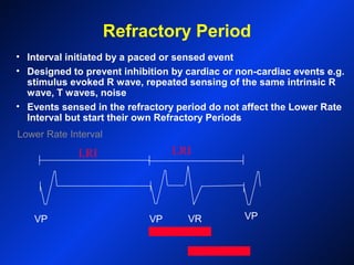 Refractory Period
Lower Rate Interval
• Interval initiated by a paced or sensed event
• Designed to prevent inhibition by cardiac or non-cardiac events e.g.
stimulus evoked R wave, repeated sensing of the same intrinsic R
wave, T waves, noise
• Events sensed in the refractory period do not affect the Lower Rate
Interval but start their own Refractory Periods
VP VP VR VP
LRI LRI
 