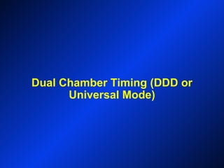 Dual Chamber Timing (DDD or
Universal Mode)
 