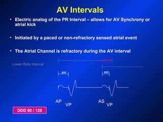 AP
VP
AS
VP
AVI AVI
Lower Rate Interval
AV Intervals
• Electric analog of the PR Interval – allows for AV Synchrony or
atrial kick
• Initiated by a paced or non-refractory sensed atrial event
• The Atrial Channel is refractory during the AV interval
DDD 60 / 120
 