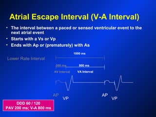 Lower Rate Interval
AP
VP
AP
VP
AV Interval VA Interval
Atrial Escape Interval (V-A Interval)
• The interval between a paced or sensed ventricular event to the
next atrial event
• Starts with a Vs or Vp
• Ends with Ap or (prematurely) with As
DDD 60 / 120
PAV 200 ms; V-A 800 ms
200 ms 800 ms
1000 ms
 