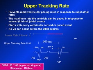 AS
VP
AS
VP
DDDR 60 / 100 (upper tracking rate)
Sinus rate: 100 bpm
Lower Rate Interval {
Upper Tracking Rate Limit
Upper Tracking Rate
SAV
SAV
VA VA
• Prevents rapid ventricular pacing rates in response to rapid atrial
rates
• The maximum rate the ventricle can be paced in response to
sensed (intrinsic)atrial events
• Starts with every ventricular sensed or paced event
• No Vp can occur before the UTRI expires
SAV
600 ms
 