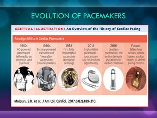 EVOLUTION OF PACEMAKERS
 