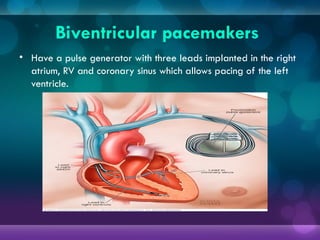 Biventricular pacemakers
• Have a pulse generator with three leads implanted in the right
atrium, RV and coronary sinus which allows pacing of the left
ventricle.
 