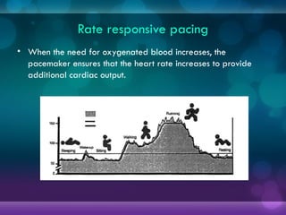 Rate responsive pacing
• When the need for oxygenated blood increases, the
pacemaker ensures that the heart rate increases to provide
additional cardiac output.
 