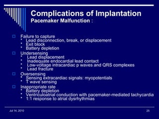 Complications of Implantation  Pacemaker Malfunction  : Failure to capture    *   Lead disconnection, break, or displacement   *   Exit block   *   Battery depletion    Undersensing    *    Lead displacement   *    Inadequate endocardial lead contact   *    Low-voltage intracardiac p waves and QRS complexes   *    Lead fracture    Oversensing     *    Sensing extracardiac signals: myopotentials   *  T wave sensing    Inappropriate rate    *   Battery depletion   *   Ventriculoatrial conduction with pacemaker-mediated tachycardia   *   1:1 response to atrial dysrhythmias 