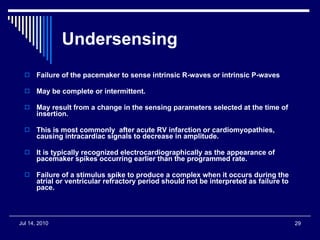 Undersensing Failure of the pacemaker to sense intrinsic R-waves or intrinsic P-waves May be complete or intermittent.  May result from a change in the sensing parameters selected at the time of insertion.  This is most commonly  after acute RV infarction or cardiomyopathies, causing intracardiac signals to decrease in amplitude.  It is typically recognized electrocardiographically as the appearance of pacemaker spikes occurring earlier than the programmed rate.  Failure of a stimulus spike to produce a complex when it occurs during the atrial or ventricular refractory period should not be interpreted as failure to pace. 