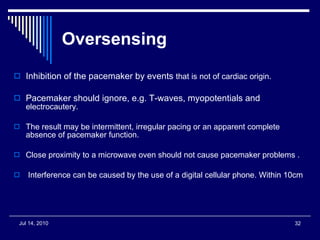 Oversensing   Inhibition of the pacemaker by events  that is not of cardiac origin. Pacemaker should ignore, e.g. T-waves, myopotentials and  electrocautery. The result may be intermittent, irregular pacing or an apparent complete absence of pacemaker function.  Close proximity to a microwave oven should not cause pacemaker problems . Interference can be caused by the use of a digital cellular phone. Within 10cm 