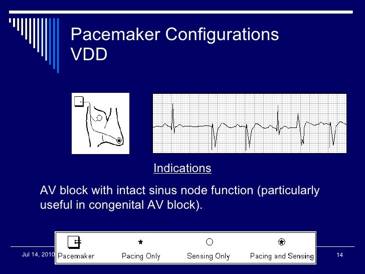 Pacer ppt