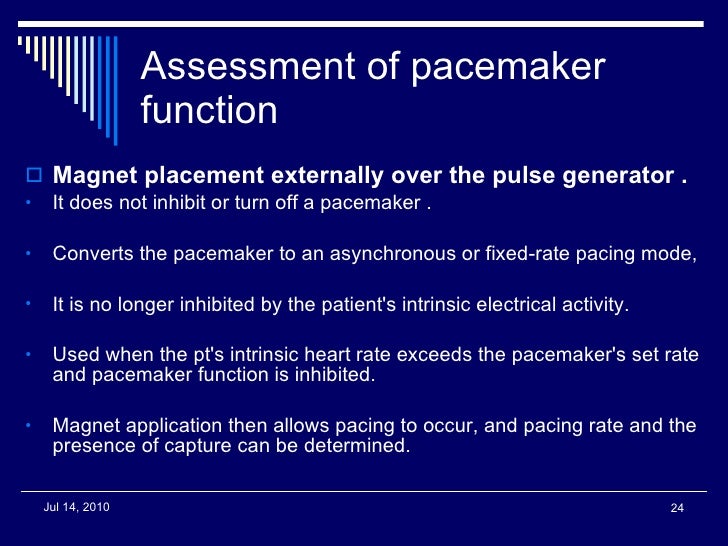 Pacer ppt