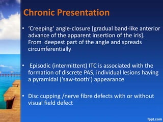 Chronic Presentation
• ‘Creeping’ angle-closure [gradual band-like anterior
advance of the apparent insertion of the iris].
From deepest part of the angle and spreads
circumferentially
• Episodic (intermittent) ITC is associated with the
formation of discrete PAS, individual lesions having
a pyramidal (‘saw-tooth’) appearance
• Disc cupping /nerve fibre defects with or without
visual field defect
 