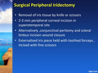 Surgical Peripheral Iridectomy
• Removal of iris tissue by knife or scissors
• 2-3 mm peripheral corneal incision in
superotemporal site
• Alternatively ,conjunctival peritomy and scleral
limbus incision wound closure
• Externalised iris piece held with toothed forceps ,
incised with fine scissors
 