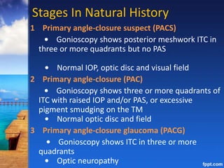 Stages In Natural History
1 Primary angle-closure suspect (PACS)
• Gonioscopy shows posterior meshwork ITC in
three or more quadrants but no PAS
• Normal IOP, optic disc and visual field
2 Primary angle-closure (PAC)
• Gonioscopy shows three or more quadrants of
ITC with raised IOP and/or PAS, or excessive
pigment smudging on the TM
• Normal optic disc and field
3 Primary angle-closure glaucoma (PACG)
• Gonioscopy shows ITC in three or more
quadrants
• Optic neuropathy
 