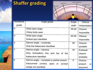 Shaffer grading
 