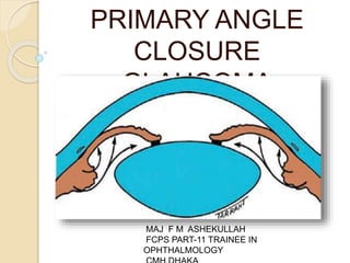PRIMARY ANGLE
CLOSURE
GLAUCOMA
MAJ F M ASHEKULLAH
FCPS PART-11 TRAINEE IN
OPHTHALMOLOGY
 