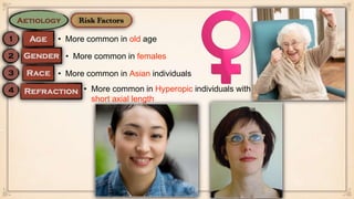 • More common in old age
• More common in Asian individuals
• More common in Hyperopic individuals with
short axial length
• More common in females
 