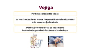 Vejiga
Pérdida de elasticidad vesical
Disminución de la fuerza de vaciamiento
factor de riesgo en las infecciones urinarias bajas
La fuerza muscular es menor, lo que facilita que la micción sea
más frecuente (polaquiuria)
 