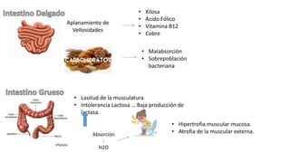 Aplanamiento de
Vellosidades
• Xilosa
• Ácido Fólico
• Vitamina B12
• Cobre
• Malabsorción
• Sobrepoblación
bacteriana
• Lasitud de la musculatura
• Intolerancia Lactosa … Baja producción de
lactasa.
Absorción
:
H2O
• Hipertrofia muscular mucosa.
• Atrofia de la muscular externa.
 