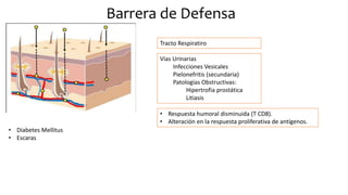 Barrera de Defensa
• Diabetes Mellitus
• Escaras
Tracto Respiratiro
Vías Urinarias
Infecciones Vesicales
Pielonefritis (secundaria)
Patologías Obstructivas:
Hipertrofia prostática
Litiasis
• Respuesta humoral disminuida (T CD8).
• Alteración en la respuesta proliferativa de antígenos.
 