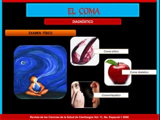 DIAGNÓSTICO
Revista de las Ciencias de la Salud de Cienfuegos Vol. 11, No. Especial 1 2006
EXAMEN FÍSICO
Coma etílico
Coma diabético
ComavHepático
 