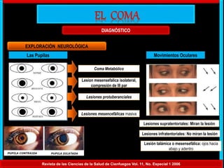 Revista de las Ciencias de la Salud de Cienfuegos Vol. 11, No. Especial 1 2006
DIAGNÓSTICO
Las Pupilas
EXPLORACIÓN NEUROLÓGICA
Coma Metabólico
Lesiones protuberanciales
Lesiones mesencefálicas masiva
Movimientos Oculares
Lesiones supratentoriales: Miran la lesión
Lesiones infratentoriales: No miran la lesión
Lesión talámica o mesensefálica: ojos hacia
abajo y adentro
Lesion mesensefalica isolateral,
compresión de III par
 