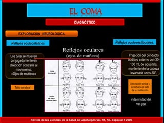 Revista de las Ciencias de la Salud de Cienfuegos Vol. 11, No. Especial 1 2006
DIAGNÓSTICO
EXPLORACIÓN NEUROLÓGICA
Reflejos oculocefálicos Reflejos oculovestibulares.
Los ojos se mueven
conjugadamente en
dirección contraria al
movimiento.
«Ojos de muñeca»
Irrigación del conducto
auditivo externo con 30-
100 mL de agua fría,
manteniendo la cabeza
levantada unos 30°.
indemnidad del
VIII par
Tallo cerebral
Desviación tónica y
lenta hacia el lado
de la instilaciíón
 