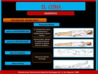 Revista de las Ciencias de la Salud de Cienfuegos Vol. 11, No. Especial 1 2006
DIAGNÓSTICO
EXPLORACIÓN NEUROLÓGICA
Respuesta Motora
postura de DESCEREBRACIÓN
postura de DECORTICACIÓN
Signo De Brudzinski.
Signo de Kernig
H. transtentorial, lesion
protuberancia o
hipoglucemia o hipoxia
intensa.
lesiones altas, afectan
la sustancia blanca
cerebral, la cápsula
interna o el tálamo.
Signos de irritación
meníngea
 