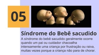 Síndrome do Bebê sacudido
A síndrome do bebê sacudido geralmente ocorre
quando um pai ou cuidador chacoalha
intensamente uma criança por frustração ou raiva,
muitas vezes porque a criança não para de chorar.
05
 