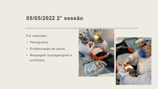 05/05/2022 2° sessão
Foi realizado:
• Periograma.
• Evidenciação de placa,
• Raspagem supragengival e
profilaxia.
 
