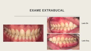 EXAME EXTRABUCAL
Lado Dir.
Lado Esq.
 