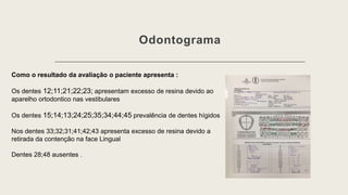 Odontograma
Como o resultado da avaliação o paciente apresenta :
Os dentes 12;11;21;22;23; apresentam excesso de resina devido ao
aparelho ortodontico nas vestibulares
Os dentes 15;14;13;24;25;35;34;44;45 prevalência de dentes hígidos
Nos dentes 33;32;31;41;42;43 apresenta excesso de resina devido a
retirada da contenção na face Lingual
Dentes 28;48 ausentes .
 