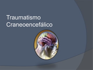 Traumatismo
Craneoencefálico
 
