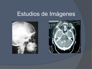 Estudios de Imágenes
 