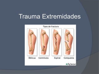Trauma Extremidades
 