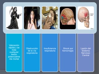 Valoración
rápida y se   Obstrucción    Insuficiencia    Shock por   Lesión del
    trata       de la vía     respiratoria   hemorragia    Sistema
  cualquier   respiratoria                                 Nervioso
   lesión                                                   Central
potencialme
 nte mortal
 
