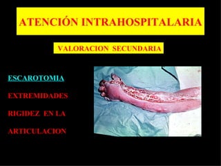 ATENCIÓN INTRAHOSPITALARIA

           VALORACION SECUNDARIA



ESCAROTOMIA

EXTREMIDADES

RIGIDEZ EN LA

ARTICULACION
 
